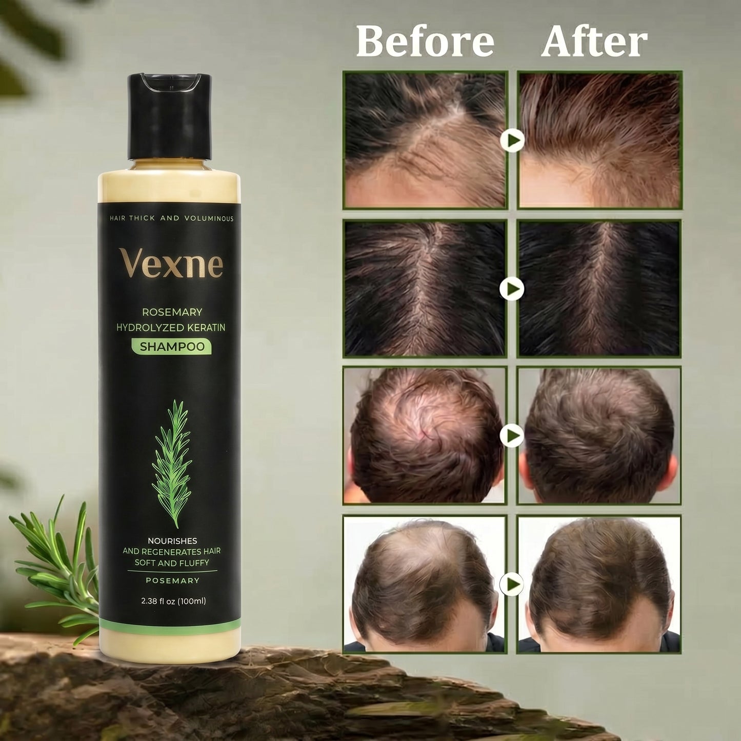🔥LAST DAY 50% OFF - Vexne® Organic Rosemary Hair Growth Shampoo