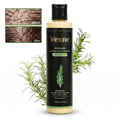 🔥LAST DAY 50% OFF - Vexne® Organic Rosemary Hair Growth Shampoo