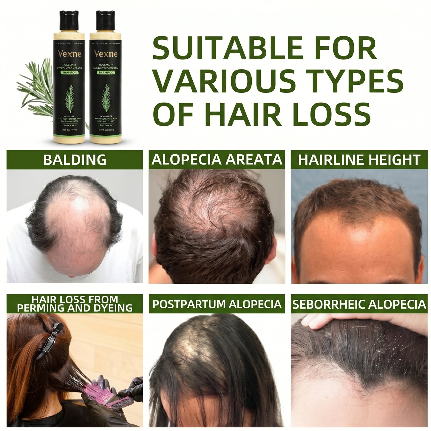🔥LAST DAY 50% OFF - Vexne® Organic Rosemary Hair Growth Shampoo